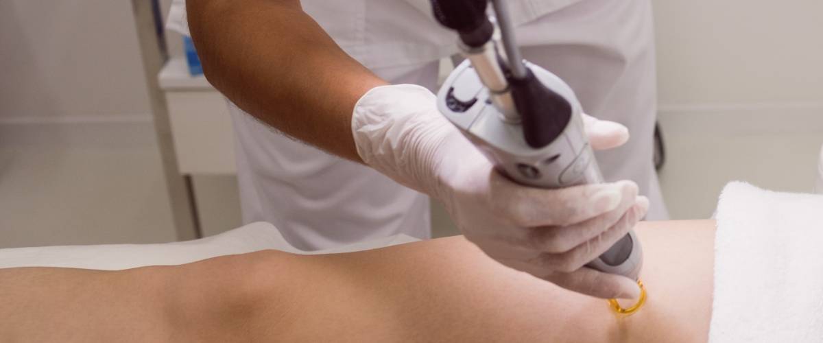 laser ontharen ceulen klinieken